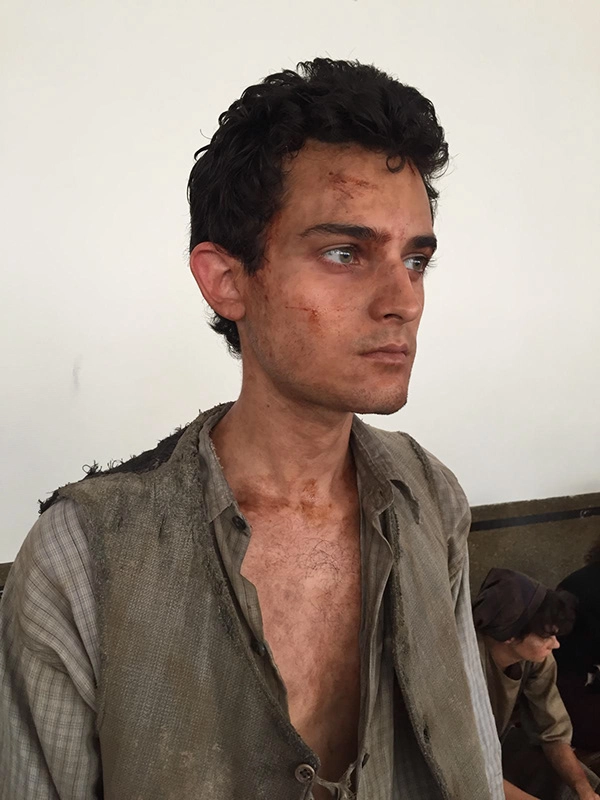 Justine Fiorito Special effects makeup for the TV series The New Look Realistic injury simulation created by Justine Fiorito in special effects makeup.