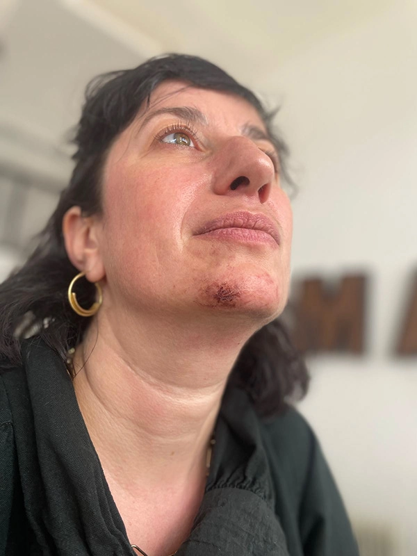 Justine Fiorito réalisant un maquillage à partir d'une prothèse transfère lors de sa formation chez Ornaré Justine Fiorito réalisant un maquillage à partir d'une prothèse transfère lors de sa formation chez Ornaré