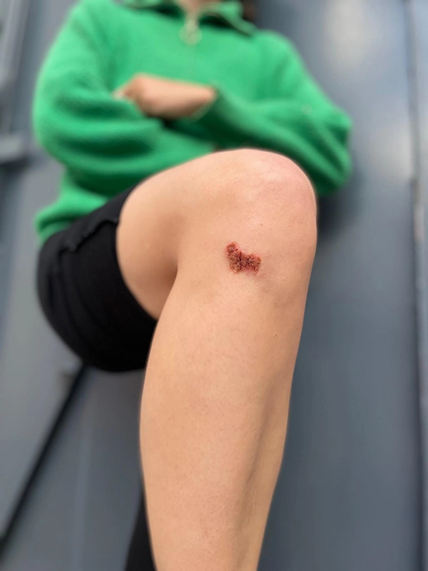 Justine Fiorito, special effects makeup creating a realistic scab Creation of a scab during the SFX2 training at Ornaré.