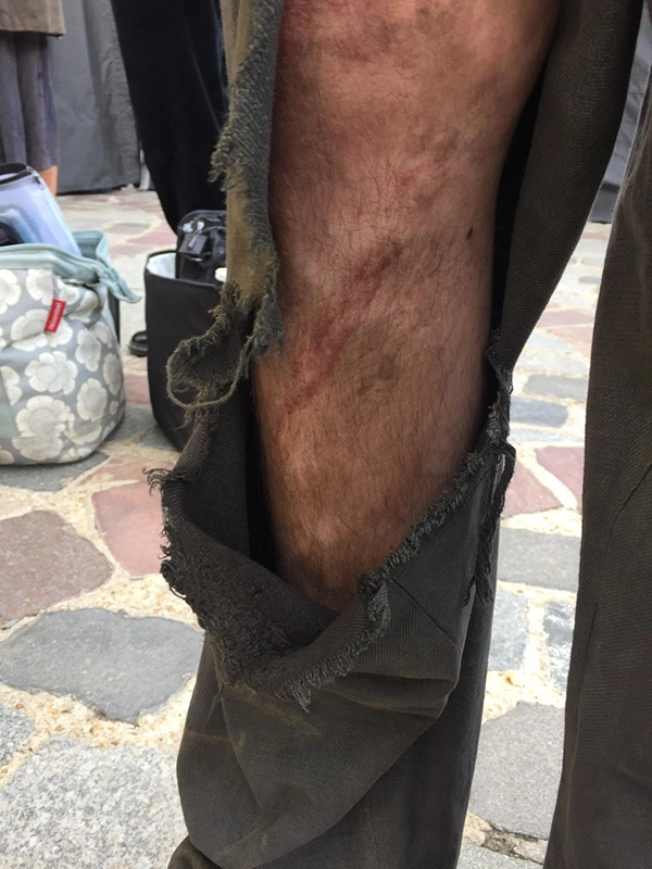 justine fiorito effet speciaux cicatrice the new look Cicatrice effet spéciaux réalisée par Justine Fiorito pour The New Look