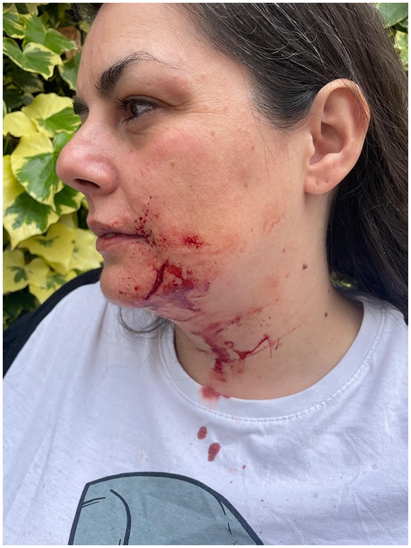 Justine Fiorito réalisant un maquillage SFX de visage tuméfié pendant une formation en effets spéciaux.