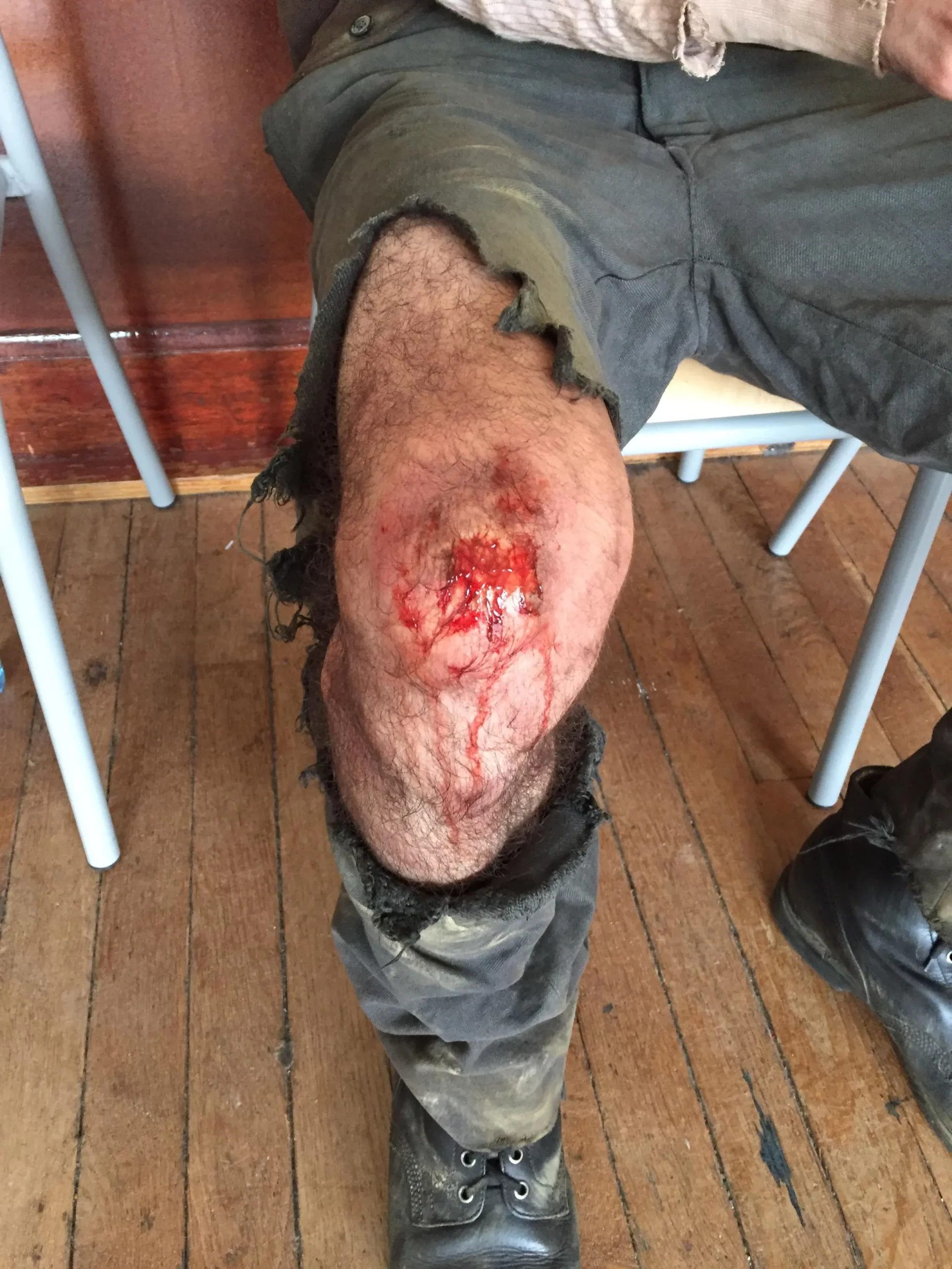 Maquillage SFX réalisé par Justine Fiorito représentant une blessure au genou sur un personnage d'époque Blessures & Patines.